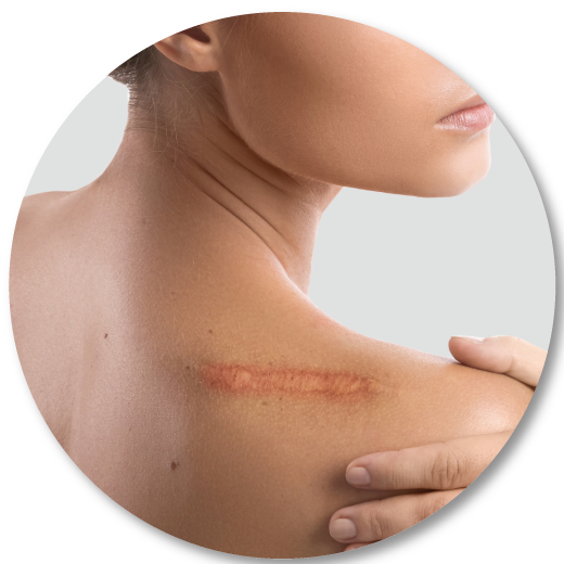 Wound-healding3 Wound-healding